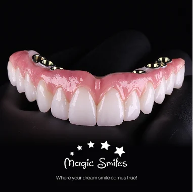 Hybrid Implant Bridge