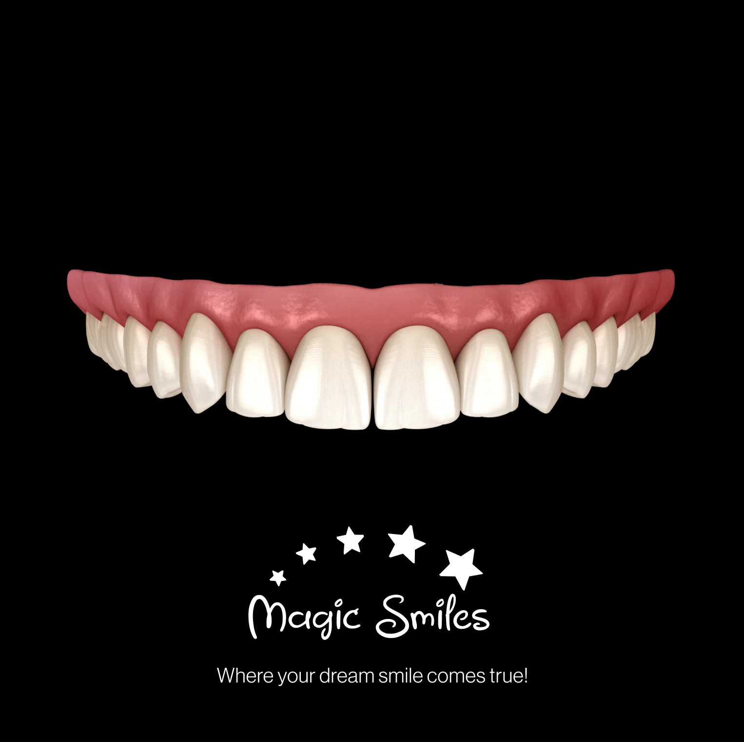 Porcelain Implant Bridge